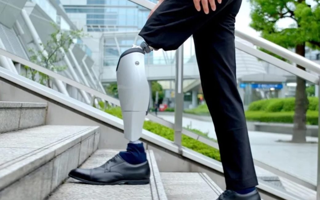 Side view of a person’s legs as they take what appears to be a natural step upward on a set of outdoor concrete stairs. The person is wearing black pants and black shoes. The pants of the uphill leg are pulled back revealing that the person is fitted with the prosthetic Bio Leg extending from just above the knee down to the shoe. The Bio Leg's small knee joint can be seen connected to the lower leg below the knee which is roughly the shape of a human lower leg. The ankle narrows down to a small joint that is partially covered by a sock. The background appears to be a business park setting with concrete and glass buildings surrounded by trees and shrubbery.